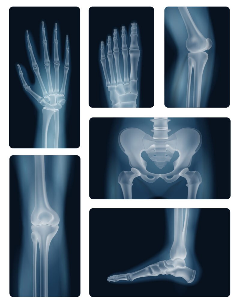 Experience Advanced Joint Replacement at OH & Cardiac Centre
