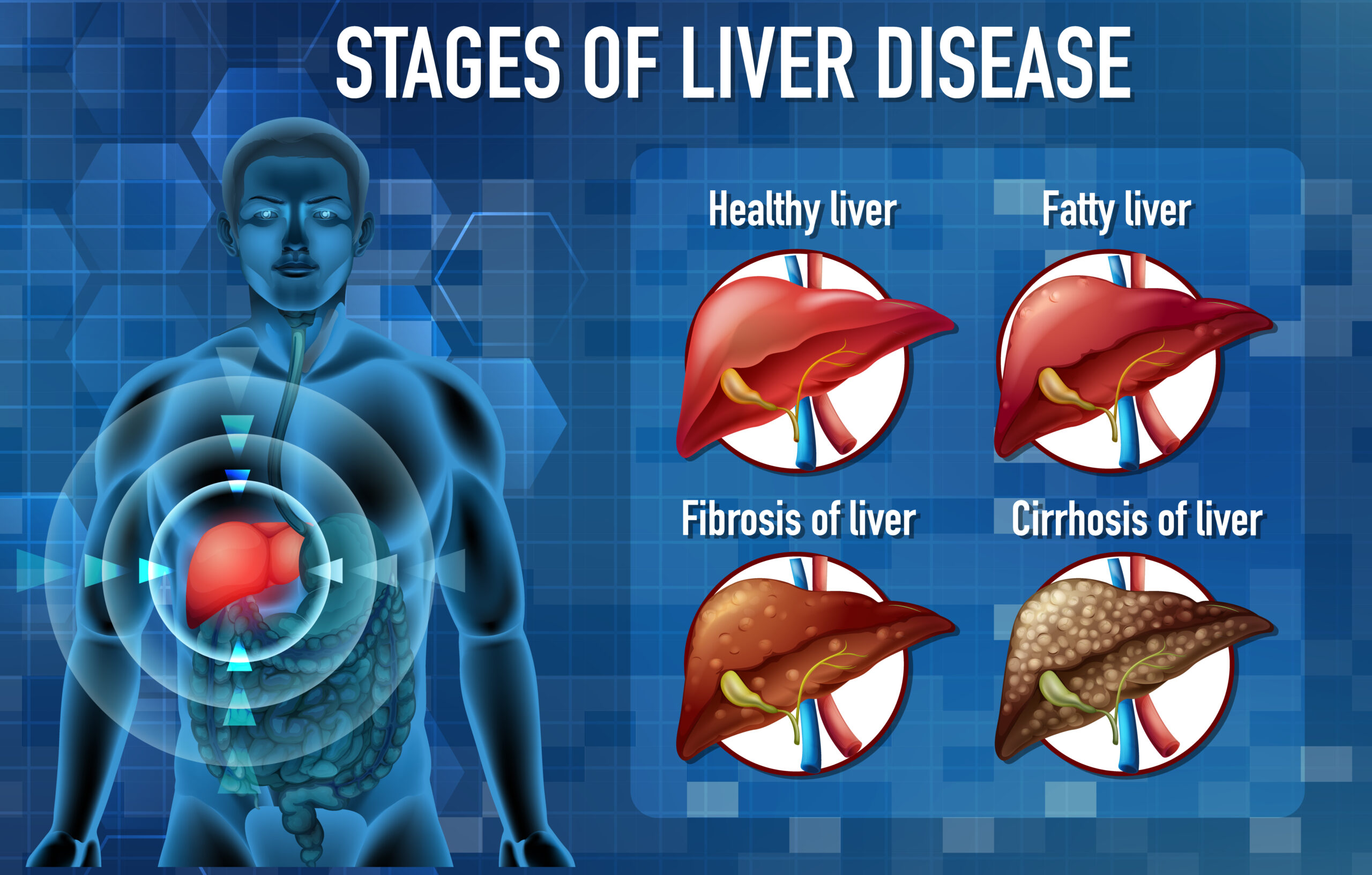 Liver Specialist