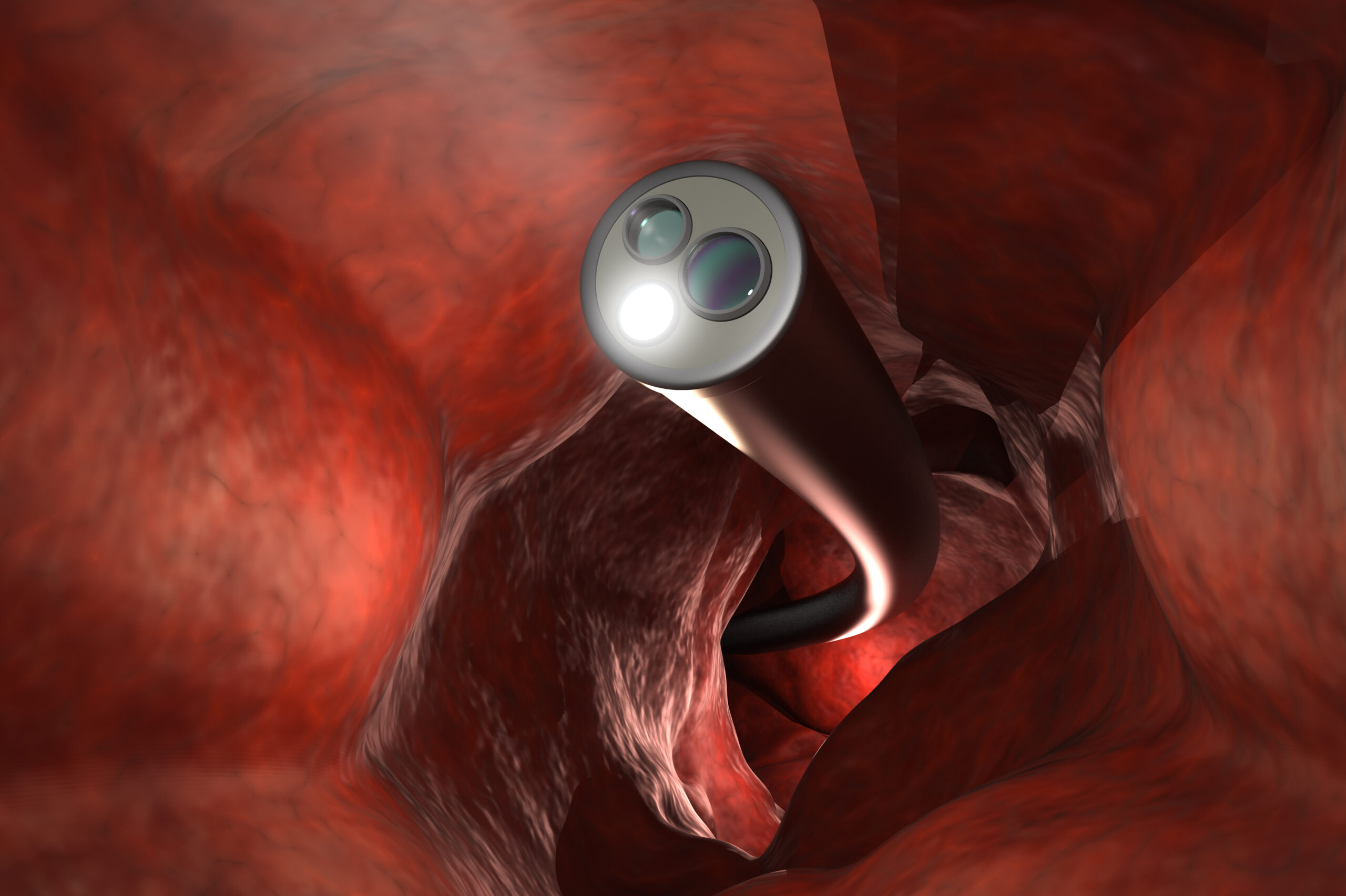 Bile Duct