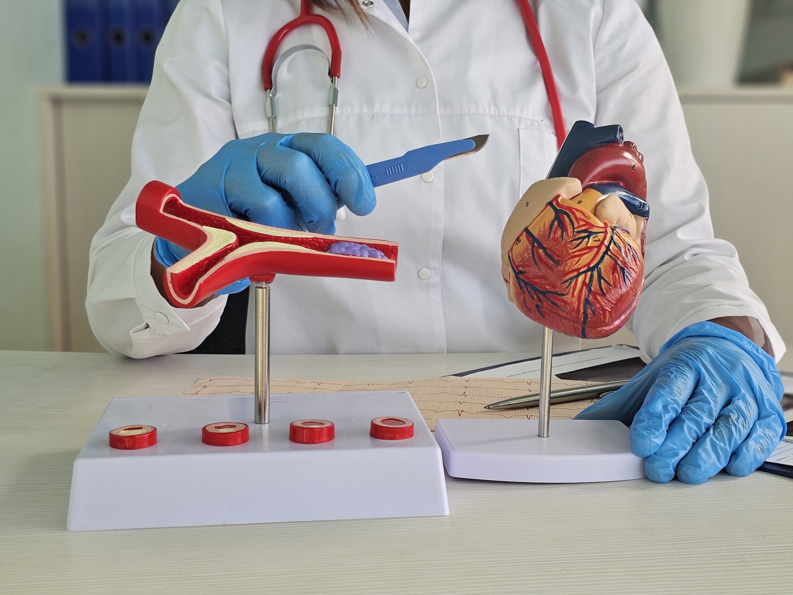 Heart Valve