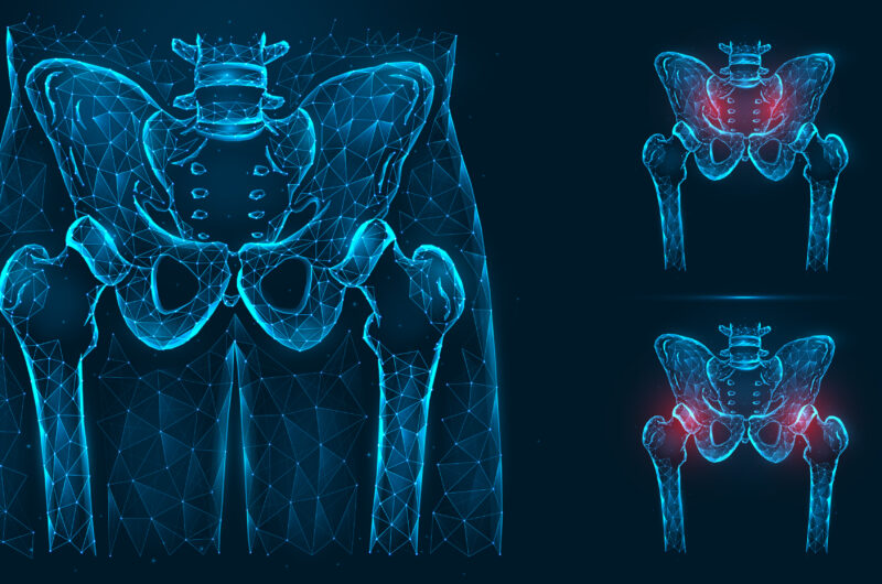 Total Hip Replacement vs Bipolar Hip Replacement: Which is Right for You?