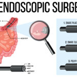 Endoscopy
