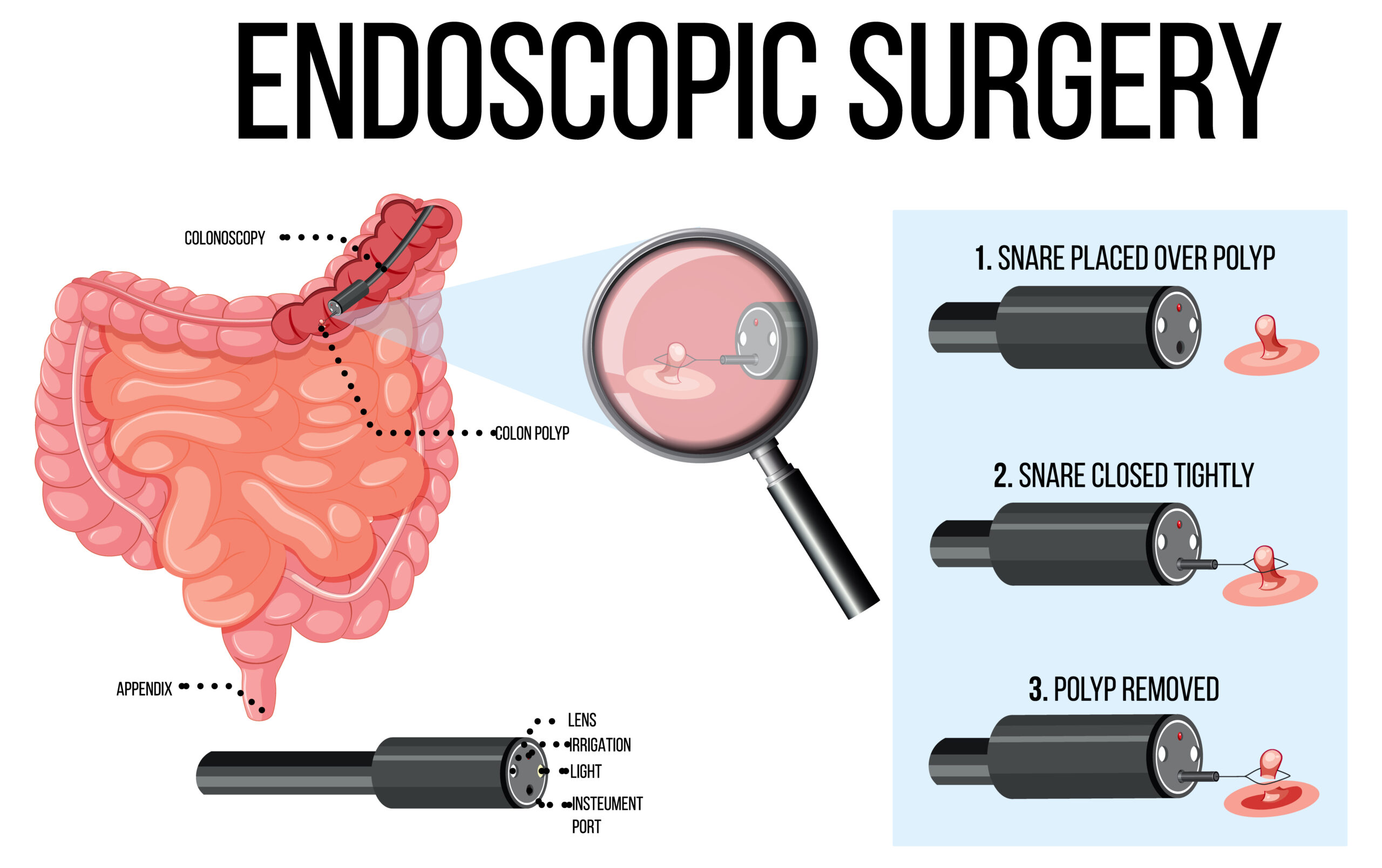 Common Misconceptions About Endoscopy: Debunking Myths and Facts