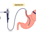 endoscopy