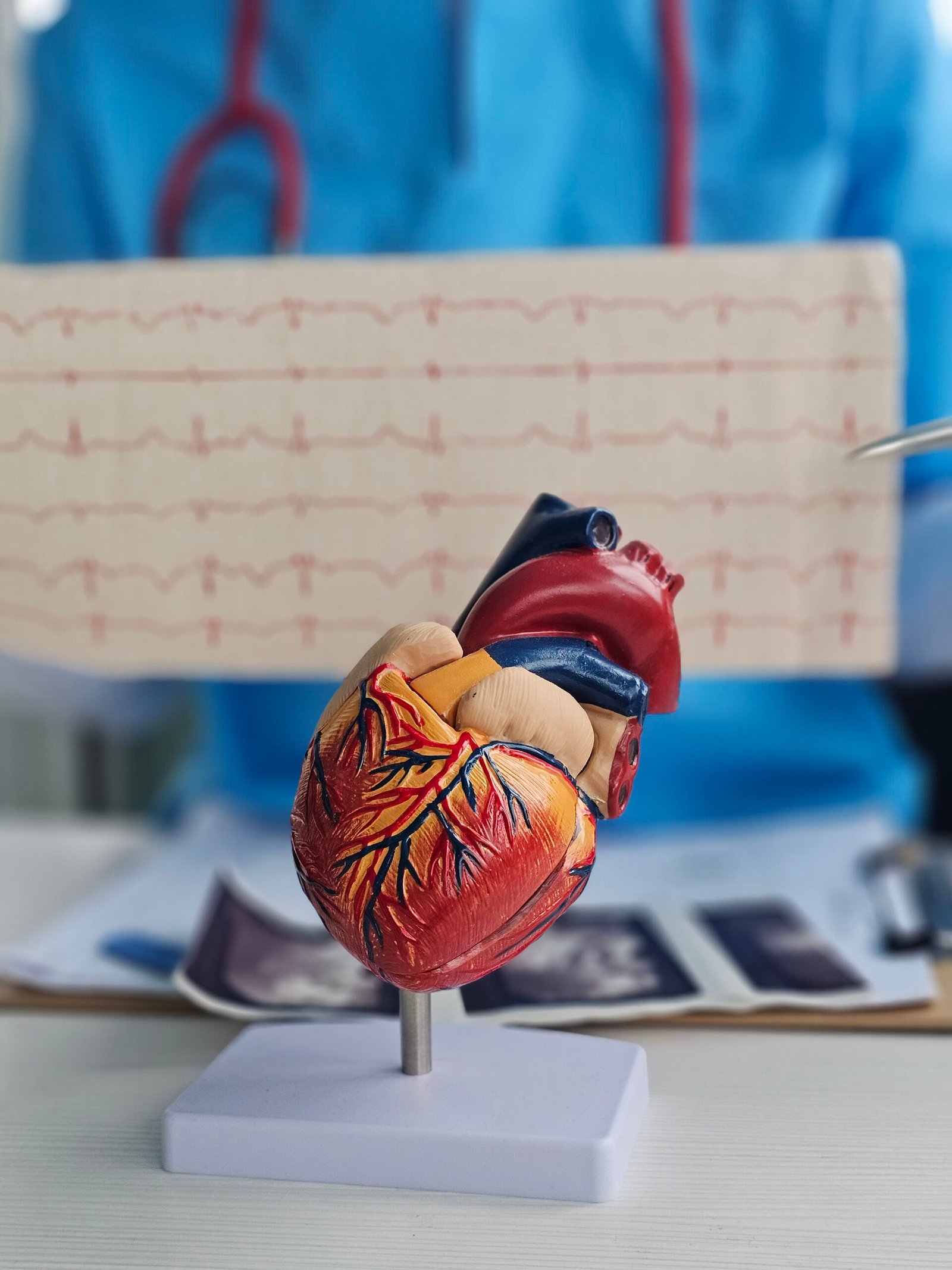 Heart Surgery