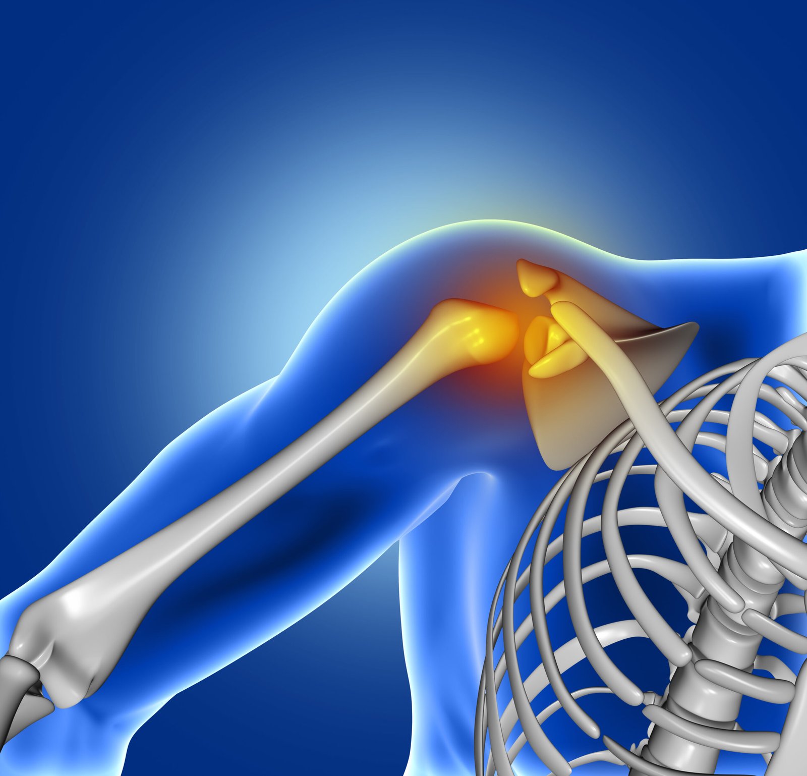 Orthopedic